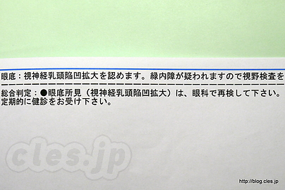 視神経乳頭陥凹拡大？ - 人間ドックの結果に要精密検査の項目があったので・・・